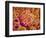 Glomerulus of kidney-Micro Discovery-Framed Photographic Print