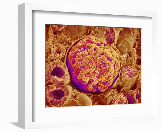 Glomerulus of kidney-Micro Discovery-Framed Photographic Print