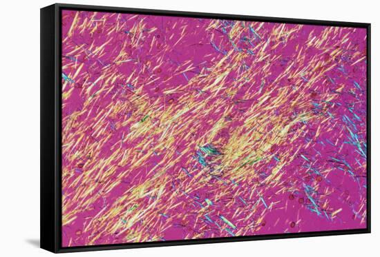 Gout Crystals-Dr. E. Walker-Framed Stretched Canvas