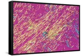 Gout Crystals-Dr. E. Walker-Framed Stretched Canvas