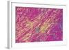 Gout Crystals-Dr. E. Walker-Framed Premium Photographic Print