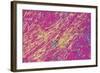 Gout Crystals-Dr. E. Walker-Framed Premium Photographic Print