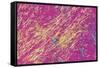 Gout Crystals-Dr. E. Walker-Framed Stretched Canvas