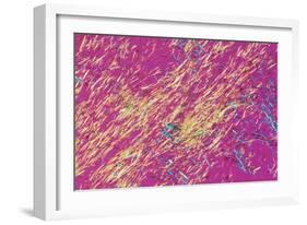 Gout Crystals-Dr. E. Walker-Framed Photographic Print