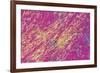 Gout Crystals-Dr. E. Walker-Framed Photographic Print