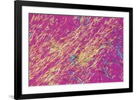 Gout Crystals-Dr. E. Walker-Framed Photographic Print