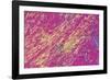 Gout Crystals-Dr. E. Walker-Framed Photographic Print