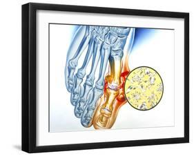 Gout-John Bavosi-Framed Photographic Print