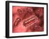 Group of Escherichia Coli Bacteria Cells, known as E. Coli-null-Framed Art Print