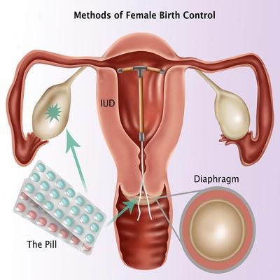 Methods of Female Birth Control