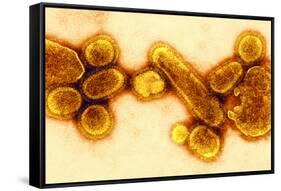H1N1 1918 Influenza Virus, TEM-CDC-Framed Stretched Canvas