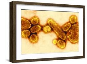 H1N1 1918 Influenza Virus, TEM-CDC-Framed Photographic Print