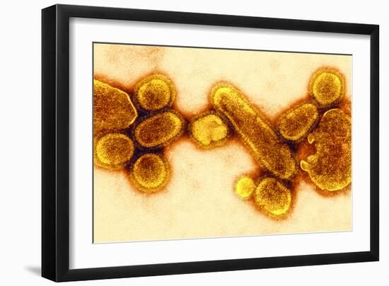 H1N1 1918 Influenza Virus, TEM-CDC-Framed Photographic Print