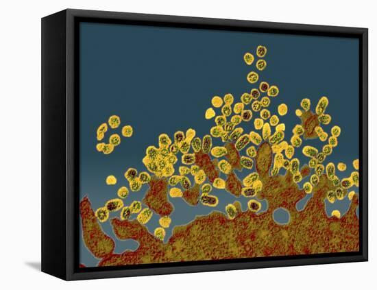 H1N1 Swine Flu Virus, TEM-Dr. Klaus Boller-Framed Stretched Canvas