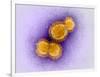 H5N1 Avian Influenza Virus Particles, TEM-Dr. Klaus Boller-Framed Photographic Print