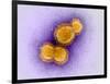 H5N1 Avian Influenza Virus Particles, TEM-Dr. Klaus Boller-Framed Photographic Print