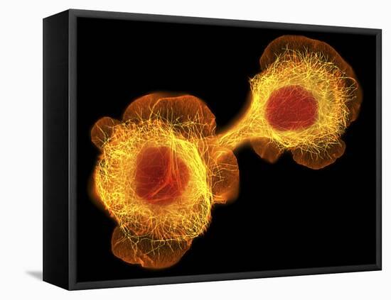 HaCaT Culture Cells, Light Micrograph-Dr. Torsten Wittmann-Framed Stretched Canvas