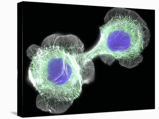 HaCaT Culture Cells, Light Micrograph-Dr. Torsten Wittmann-Stretched Canvas