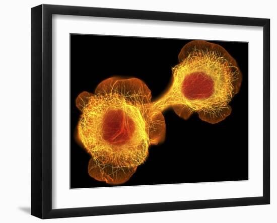 HaCaT Culture Cells, Light Micrograph-Dr. Torsten Wittmann-Framed Photographic Print