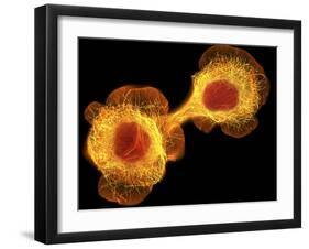 HaCaT Culture Cells, Light Micrograph-Dr. Torsten Wittmann-Framed Photographic Print