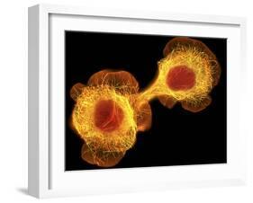 HaCaT Culture Cells, Light Micrograph-Dr. Torsten Wittmann-Framed Photographic Print