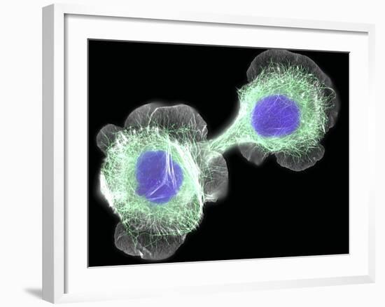 HaCaT Culture Cells, Light Micrograph-Dr. Torsten Wittmann-Framed Photographic Print