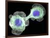 HaCaT Culture Cells, Light Micrograph-Dr. Torsten Wittmann-Framed Photographic Print