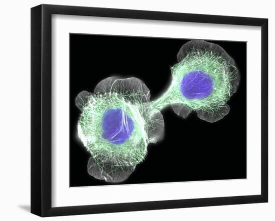 HaCaT Culture Cells, Light Micrograph-Dr. Torsten Wittmann-Framed Photographic Print