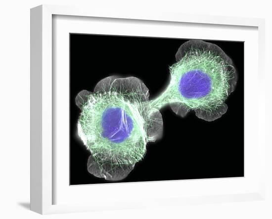 HaCaT Culture Cells, Light Micrograph-Dr. Torsten Wittmann-Framed Photographic Print