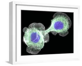 HaCaT Culture Cells, Light Micrograph-Dr. Torsten Wittmann-Framed Photographic Print