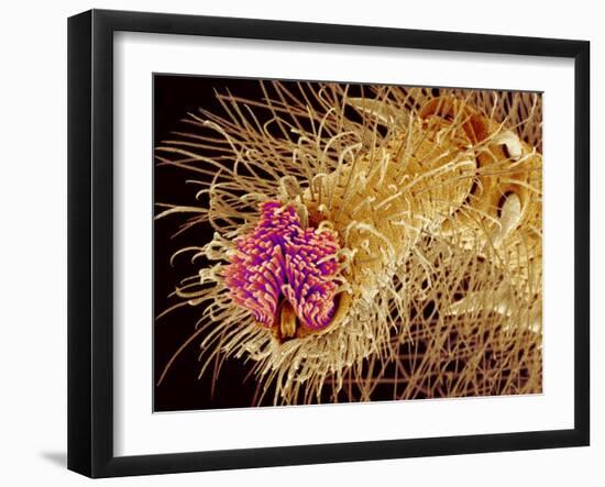 Hairs on the tip of the leg of a spider-Micro Discovery-Framed Photographic Print