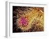 Hairs on the tip of the leg of a spider-Micro Discovery-Framed Photographic Print