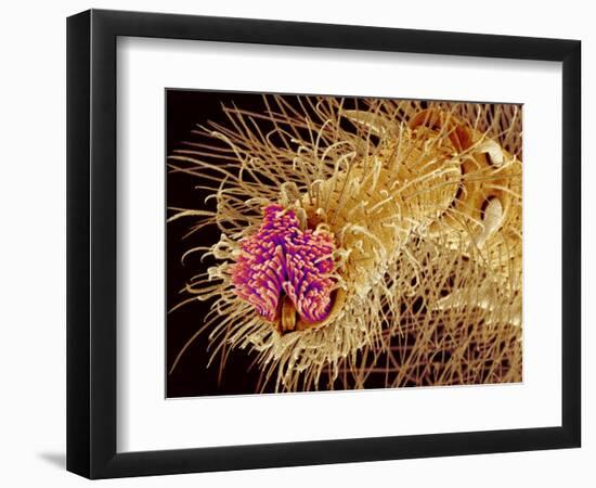 Hairs on the tip of the leg of a spider-Micro Discovery-Framed Photographic Print