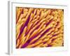 Hairs on the tip of the leg of a spider-Micro Discovery-Framed Photographic Print