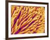 Hairs on the tip of the leg of a spider-Micro Discovery-Framed Photographic Print