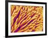 Hairs on the tip of the leg of a spider-Micro Discovery-Framed Photographic Print