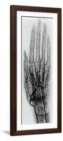 Hand Arteriogram-Science Source-Framed Premium Giclee Print