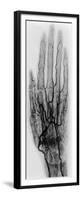 Hand Arteriogram-Science Source-Framed Premium Giclee Print