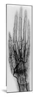 Hand Arteriogram-Science Source-Mounted Premium Giclee Print