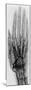 Hand Arteriogram-Science Source-Mounted Premium Giclee Print