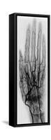 Hand Arteriogram-Science Source-Framed Stretched Canvas