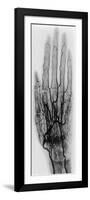 Hand Arteriogram-Science Source-Framed Giclee Print