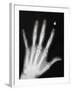 Hand Bones-Simon Jarratt-Framed Premium Photographic Print