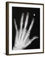 Hand Bones-Simon Jarratt-Framed Premium Photographic Print