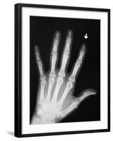 Hand Bones-Simon Jarratt-Framed Premium Photographic Print