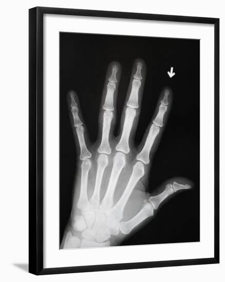 Hand Bones-Simon Jarratt-Framed Premium Photographic Print