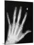 Hand Bones-Simon Jarratt-Mounted Premium Photographic Print