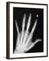 Hand Bones-Simon Jarratt-Framed Photographic Print