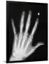 Hand Bones-Simon Jarratt-Framed Photographic Print