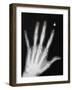 Hand Bones-Simon Jarratt-Framed Photographic Print